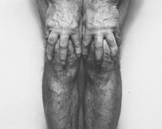 Self Portrait (Hands Spread on Knees), 1985