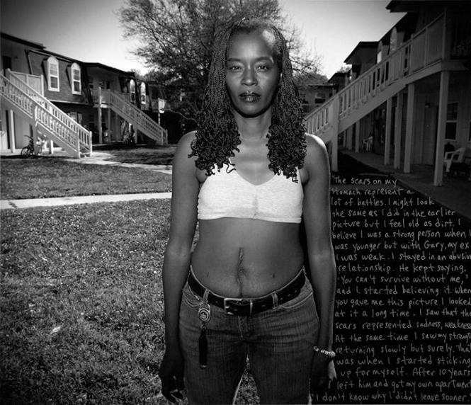 Kym with Caesarean Scar, Woodland Springs Apartments, from the "Pigeon Hill: Then & Now" series