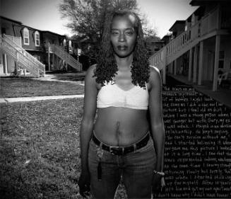 Kym with Caesarean Scar, Woodland Springs Apartments, from the "Pigeon Hill: Then & Now" series